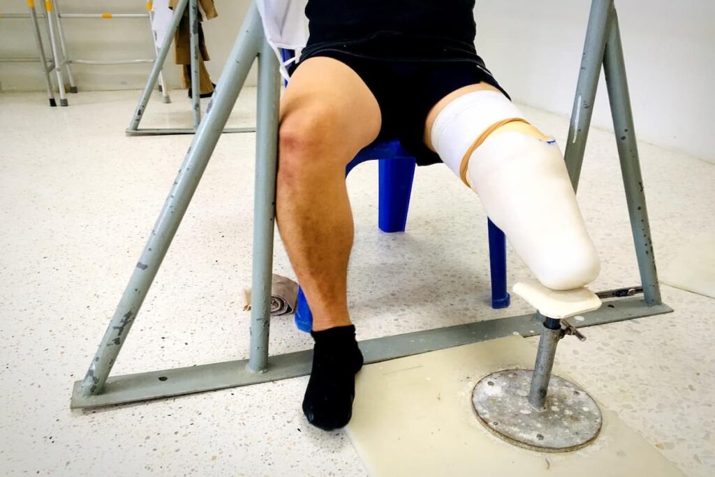 قطع عضو چگونه انجام می‌شود؟