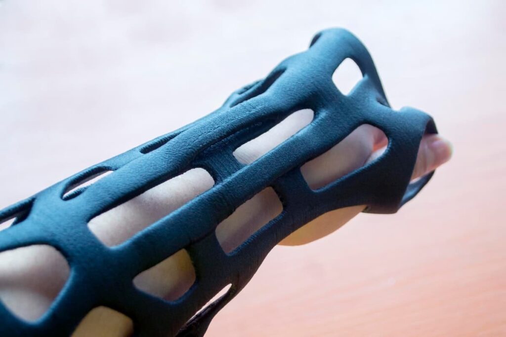 ارتزهای اندام فوقانی