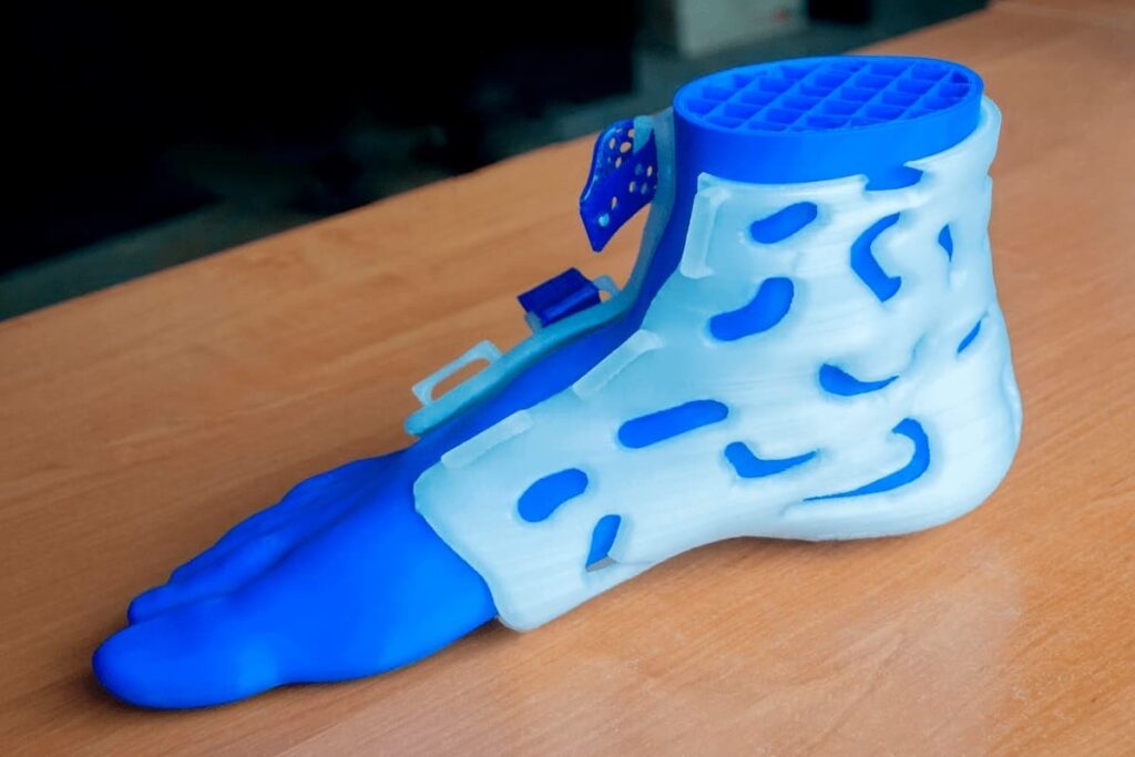 مراحل سفارش و ساخت ارتز یا بریس