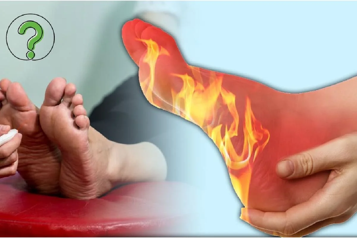 داغ شدن و سوزش کف پا نشانه چیست؟
